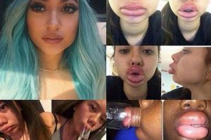 kylie-lips