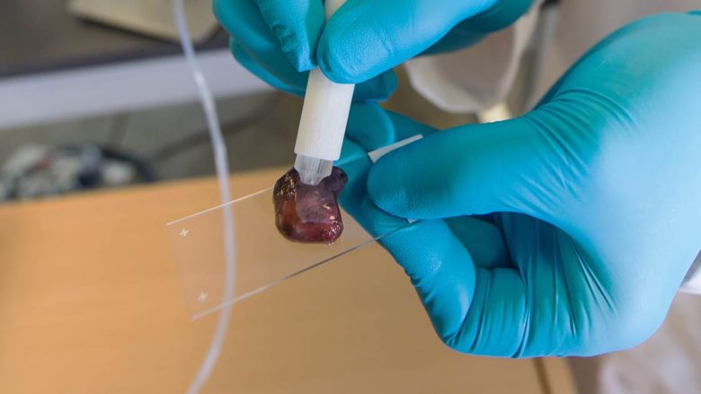 Zbulimi i mrekullueshëm: Lapsi që zbulon kancerin për vetëm 10 sekonda (VIDEO)