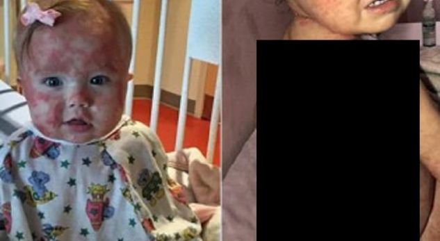 E akuzuan se harroi vajzën në diell, e vërteta për vogëlushen do ju rrëqethë mishin