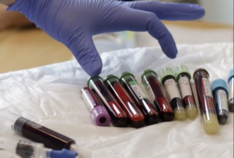 Metoda e re për të luftuar kancerin, imunoterapia