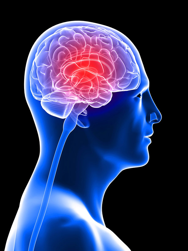 Goditja në tru, si të njihni simptomat?