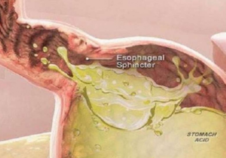 Mjekët japin alarmin: Mos e hani këtë ushqim, formon krimba në trupin tuaj