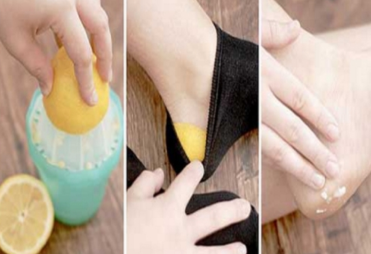 Vendosni limon në çorape dhe shikoni çfarë do të ndodhë