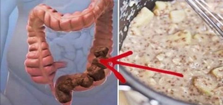 Pini një filxhan nga kjo pije e mahnitshme çdo natë para gjumit: Do të pastrojë zorrën e trashë dhe do të djegë yndyrnat ndërsa flini!