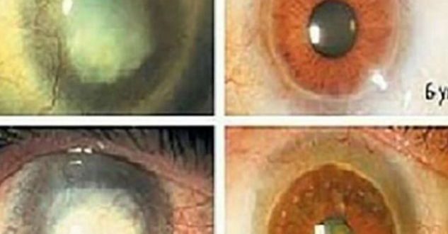 Keni probleme me shiqimin? Kjo është receta që rikthen shikimin!