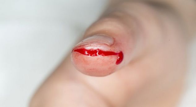 Shkenca tregon përse prerjet me letër shkaktojnë dhimbje të tmerrshme