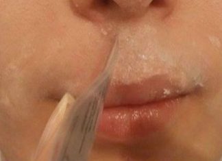 Receta 15 minutëshe që largon përgjithmonë qimet nga fytyra juaj