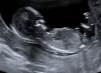 Shkencëtarët kanë zbuluar sekretin e pabesueshëm të cilin ultrazëri e fsheh mbi të ardhmen e bebes