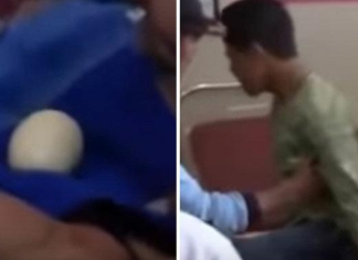 E pabesueshme, adoleshenti shokon mjekët, bën 20 vezë (FOTO)