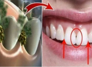 Largoni erën e keqe nga goja me këtë përbërës magjik