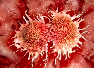 Një hap historik në luftën kundër kancerit, nis zbatimi i terapisë gjenetike me qeliza të modifikuara