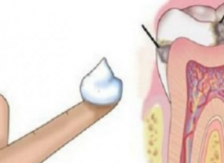 Pse dentistët nuk duan që ta mësoni këtë? Një zgjidhje e thjeshtë për ta luftuar dëmtimin e dhëmbëve