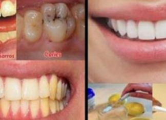 Thuaj lamtumirë kariesit, tartarit dhe ngjyrës së verdhë të dhëmbëve me ndihmën e këtij ilaçi!