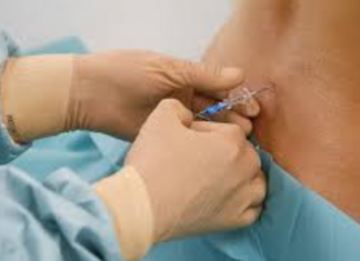 Çfarë nuk dini për gjilpërën që ju lehtëson nga dhimbjet gjatë lindjes, ja efektet anësore që mjekët i fshehin