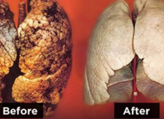 Bëjini një nder vetes! Njihuni me recetën që pastron si me magji mushkëritë e duhanpirësve