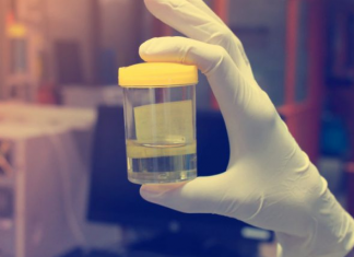 Ngjyra e urinës tregon gjithçka që duhet të dini për shëndetin tuaj