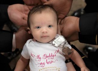 Prekëse arsyeja që kjo foshnje dy muajshe përloti botën