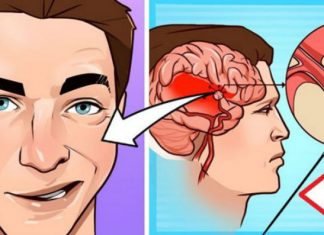 Shtohen rastet e goditjeve në tru, mjekët tregojnë se si mund t’i shpëtoni jetën një personi