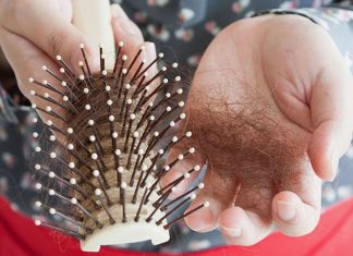 Ja arsyet më të shpeshta pse ju bien flokët