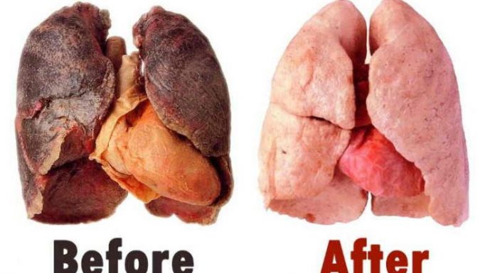 Lung-Elixer-Makeover-750x430