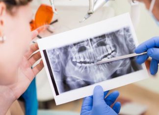 Studimet më të reja tregojnë përse nuk do të duhej të nxirrni dhëmballët