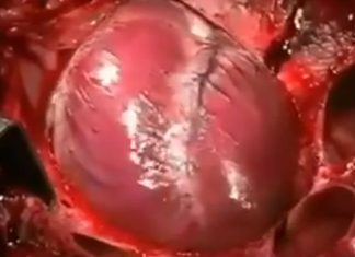 Shikoni si ndalon zemra rrahjet kur njeriu ndërron jetë (VIDEO)