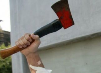 Shqiptari nga Kosova tmeron me sëpatë mjekët që nuk u kujdesën për vajzën e tij 2 vjeçare (FOTO)