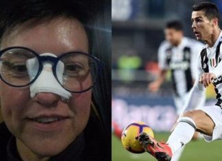 Tifozja e goditur i kërkoi darkë, ja si e surprizon Ronaldo fansen që i theu hundën (FOTO)