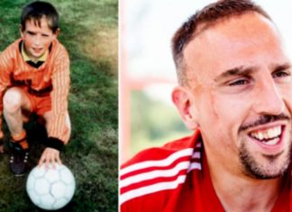 Ribery flet për shenjat e tij në fytyrë