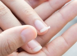 Shpëtim për thonj të dobët dhe të çarë: E gjitha që ju duhet janë këta tre përbërës!