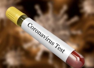 Gjashtë persona tjerë nga Dibra janë testuar për coronavirus në Maqedoni, në mesin e tyre edhe një doktor