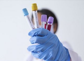 Luftimi i coronavirusit, çfarë lloje testesh ekzistojnë, si funksionojnë dhe sa janë të sakta