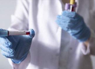 Maqedoni, në këtë vend koronavirusi ishte i pranishëm prej vitit të ri