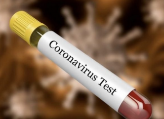 Në Maqedoni ka 48 raste të reja me coronavirus, arrin numri në 711 të diagnostikuar