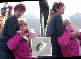 Nuk gjente dot dentist gjatë karantinës, burri i shkul të shoqes dhëmballën me pincë (FOTO)