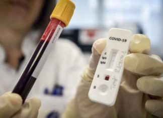 Ja sa kushton testi për Covid-19 në Maqedoni dhe a vlen për Gjermani