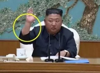 Shëndeti i liderit komunist, çfarë tregojnë shenjat në krahun e Kim Jong un