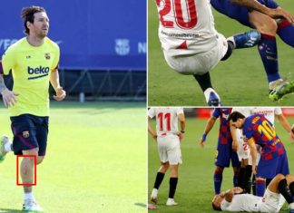 Lëndimi i Messit i pësuar në barazimin ndaj Sevillës shqetëson Barcelonën, ylli argjentinas shihet me një plagë serioze në këmbën e djathtë