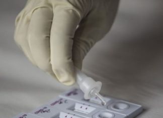 Qytetarët paguajnë deri në 120 euro për testin për koronavirus, por bëni kujdes