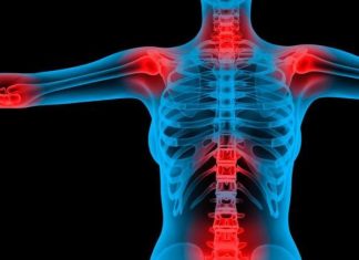 Fibromialgjia: Dhimbja e vazhdueshme e muskujve, cilat janë shkaqet dhe si shfaqet