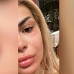 U përfol se u sulmua nga kolegët, Luana Vjollca u përgjigjet për herë të parë të gjithë skeptikëve