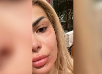 U përfol se u sulmua nga kolegët, Luana Vjollca u përgjigjet për herë të parë të gjithë skeptikëve