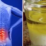 Aplikoni këtë përzierje natyrale çdo mëngjes, nuk do ndjeni dhimbjet e kësaj sëmundje për disa vite