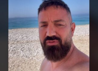 Me sy të nxirë dhe krah të thyer, kush e ka “dhunuar” Vis Pupën, dashnorja apo gruaja?