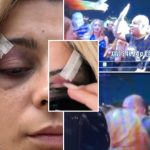 Publikohen të tjera pamje nga arrestimi i sulmuesit dhe gjendja e Bebe Rexhës pas lëndimit në koncertin famëkeq