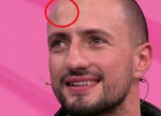 Shkaktare është Zhaklina? Krist Aliaj shfaqet në ekran me ballin e nxirë