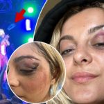 Bebe Rexha poston fotot pas incidentit: Jam mirë