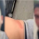 Në gjendje të rënduar psikologjike, mbërrin në familje një nga të dhunuarit në Malin e Zi: Na goditën pa asnjë arsye