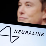 Elon Musk: Pacienti i implantit nga Neuralink mund ta lëvizë miun e kompjuterit përmes të menduarit