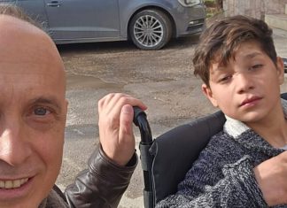 Dehari takoi Omerin, djaloshin që u kafshua nga qentë endacakë: Për çdo nevojë tjetër do të kujdesemi maksimalisht